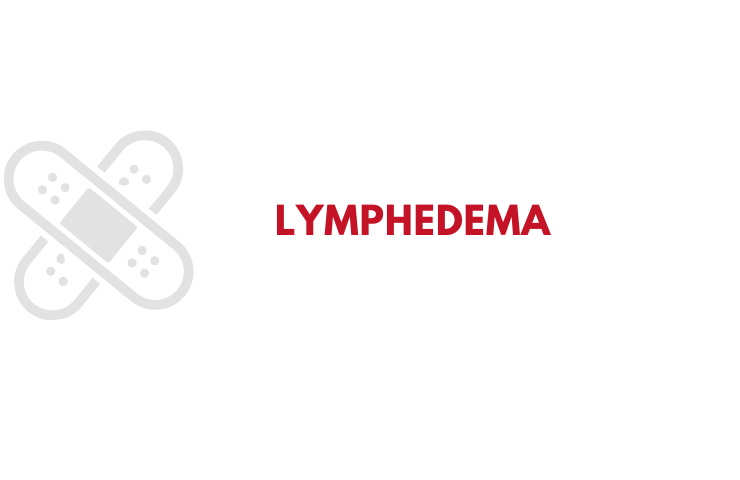 Lymphedema Infographic