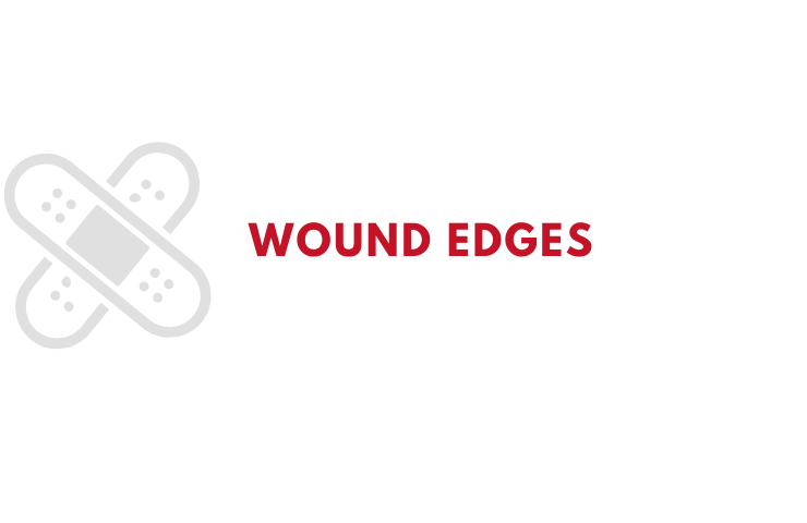 Wound Edges Infographic