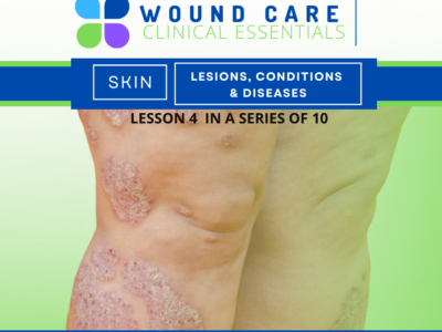 Wound Care Clinical Essentials:  Skin:  Lesions, Conditions, Diseases