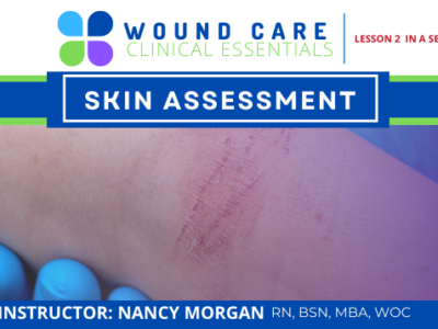 Wound Care Clinical Essentials:  Skin Assessment