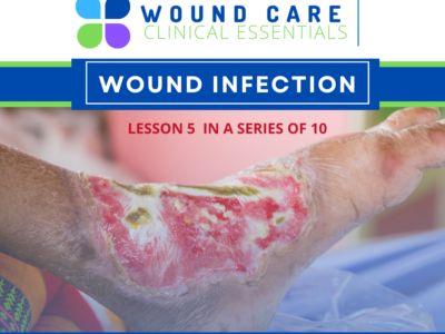 Wound Care Clinical Essentials:  Wound Infection