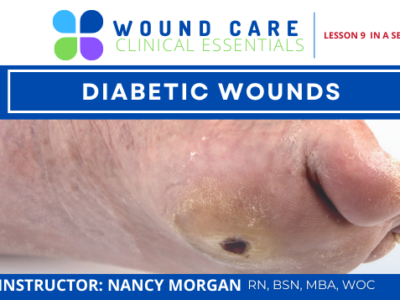 Wound Care Clinical Essentials:  Diabetic Wounds