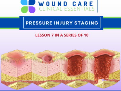 Wound Care Clinical Essentials:  Pressure Injury Staging