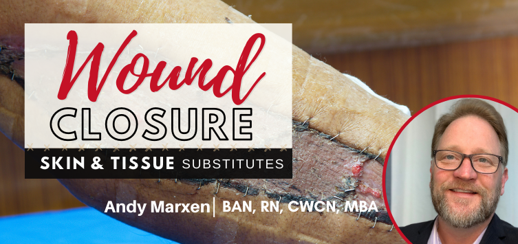 Wound Closure: Skin and Tissue Substitutes