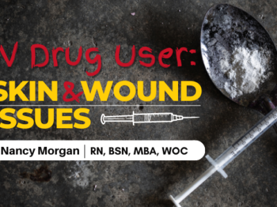 IV Drug User: Skin and Wound Issues