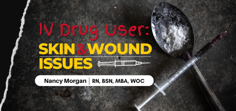 IV Drug Users:  Skin & Wound Issues