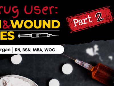 IV Drug User: Skin and Wound Issues PART 2